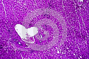 Liver edema, light micrograph