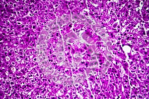 Liver edema, light micrograph