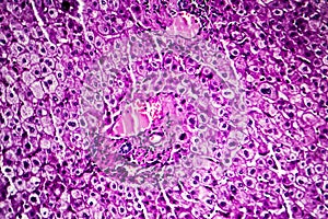 Liver edema, light micrograph