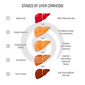 Liver failure vector concept photo