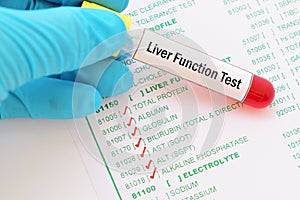 Liver function test