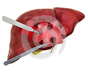 Liver or gallbladder surgery concept, 3D rendering
