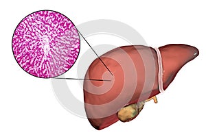 Liver illustration and micrograph