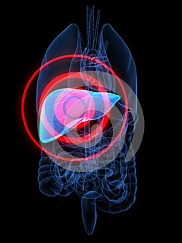 Liver inflammation