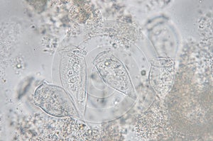 Living Vorticella is a genus of protozoan