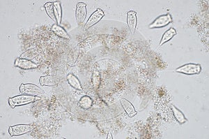 Living Vorticella is a genus of protozoan