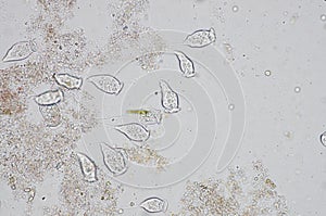 Living Vorticella is a genus of protozoan photo