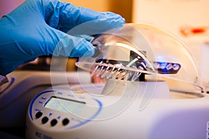 Loading samples to centrifuge