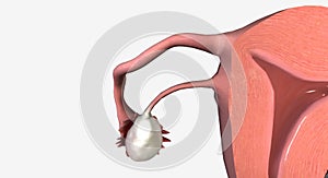 Uterus, Vagina Coronal Cross Section photo