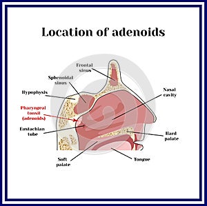 Location of adenoids.The structure of the nasopharynx photo