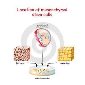 Location of mesenchymal stem cells