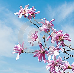 Loebner Magnolia (Magnolia x loebneri) Blossoms Against Spring S