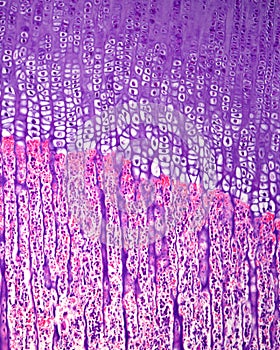 Long bone ossification. Epiphyseal growth plate photo