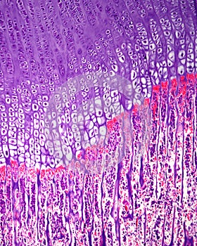 Long bone ossification. Epiphyseal growth plate photo