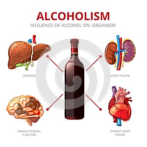 Long-term effects of alcohol. Alcoholism vector infographic