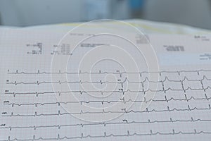 Long-term EKG for heart examination