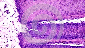 Longitudinal section of human tongue showing filiform papillae under microscope 400x