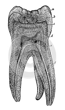 Longitudinal section through a human tooth.