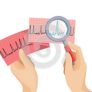 Look at atrial fibrillation through magnifying glass held by hand photo