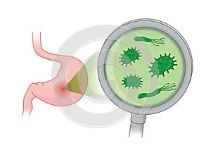 Looking Bacterial in human stomach with with Magnifying glass.