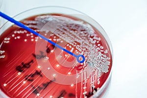 Loop for exposure Staphylococcus speciesm to colonies of white b