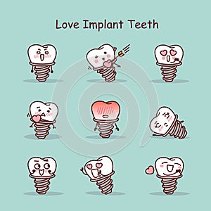 Love cartoon tooth implant set