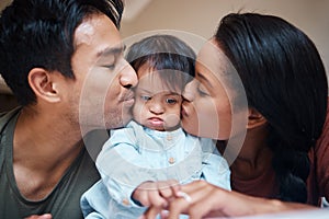 Love, disability and down syndrome parents kiss special needs kid with appreciation. Mom, dad and disabled baby in