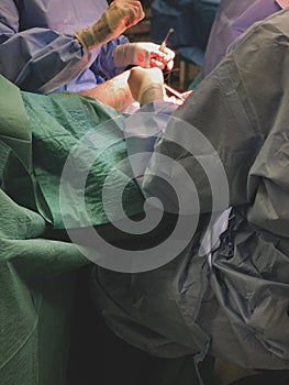 Low angle view of surgeon`s hands with surgical instruments - operating on a patient.