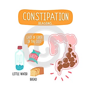 Low-fiber foods. Large intestine with fecal masses