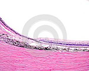 Limit retina-ciliary body photo
