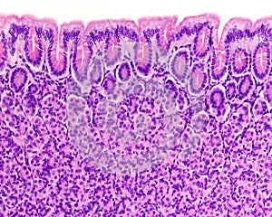 Surface of gastric mucosa photo