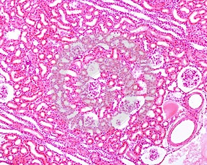 Kidney cortex. Medullary rays