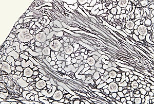 Kidney cortex. Reticular fibers photo