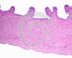 Urinary bladder layers