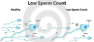 Low Sperm Count