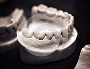 The lower jaw of a man, created on a 3d printer from a photopoly