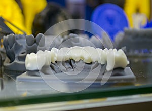 The lower jaw of a man, created on a 3d printer from a photopolymer material