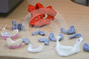 The lower jaw of a man, created on a 3d printer from a photopolymer material. Stereolithography 3D printer, technology of liquid p