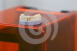 The lower jaw of a man, created on a 3d printer from a photopolymer material. Stereolithography 3D printer, technology of liquid p