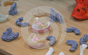 The lower jaw of a man, created on a 3d printer from a photopolymer material. Stereolithography 3D printer, technology of liquid p