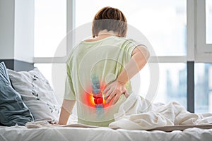 Lumbar intervertebral spine hernia, woman with back pain at home, spinal disc disease