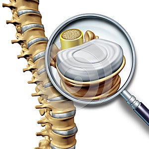 Lumbar Spine Anatomy Segment