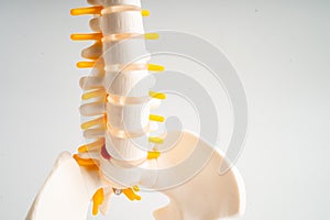 Lumbar spine displaced herniated disc fragment, spinal nerve and bone. Model for treatment medical in the orthopedic department