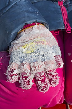 Lumps of frozen snow on gloves