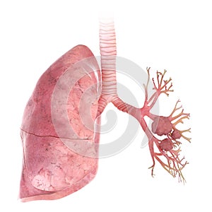 Lung cancer