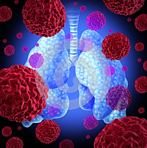 Pulmones cáncer 