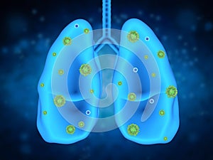 Lung disease with bacteria cells