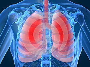 Pulmones infecciones 