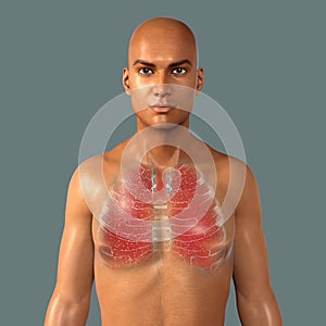 Lung tuberculosis, 3D illustration