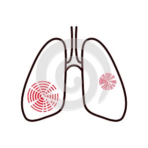 Lungs afflicted with pain, disease illustration